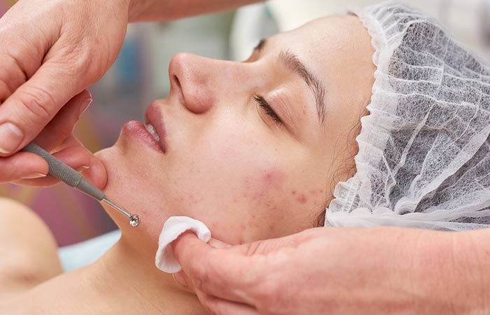 Facial reduces whiteheads and blackheads