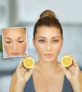 How To Use Lemon Juice For Dark Spots On ...