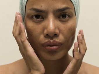 Foods For Oily Skin: What To Eat And Avoid