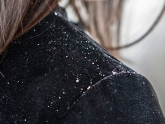 How To Get Rid Of Dandruff