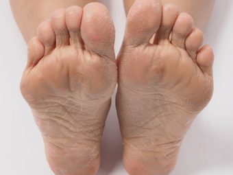 How To Remove Dead Skin From Feet