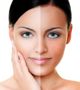 How To Remove Tan From Face And Body