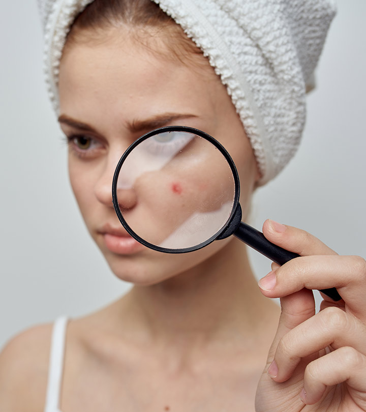 Vitamin E For Acne: Is It Effective?