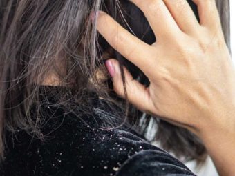 What Is The Truth About Hair Oils For Dandruff