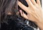 6 Best Hair Oils For Dandruff – Control...